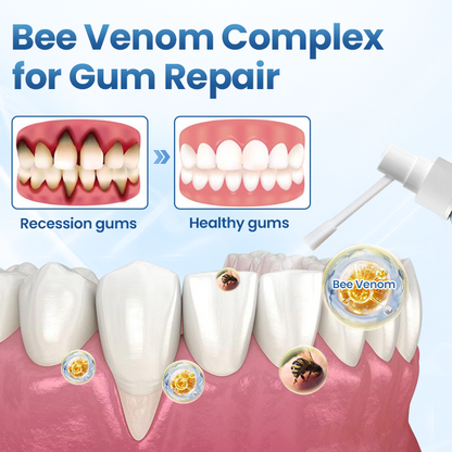 Nexisify® Gum Relief Natural Spray |🏆Recommended By Dental Experts