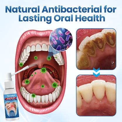 Nexisify® Gum Relief Natural Spray |🏆Recommended By Dental Experts