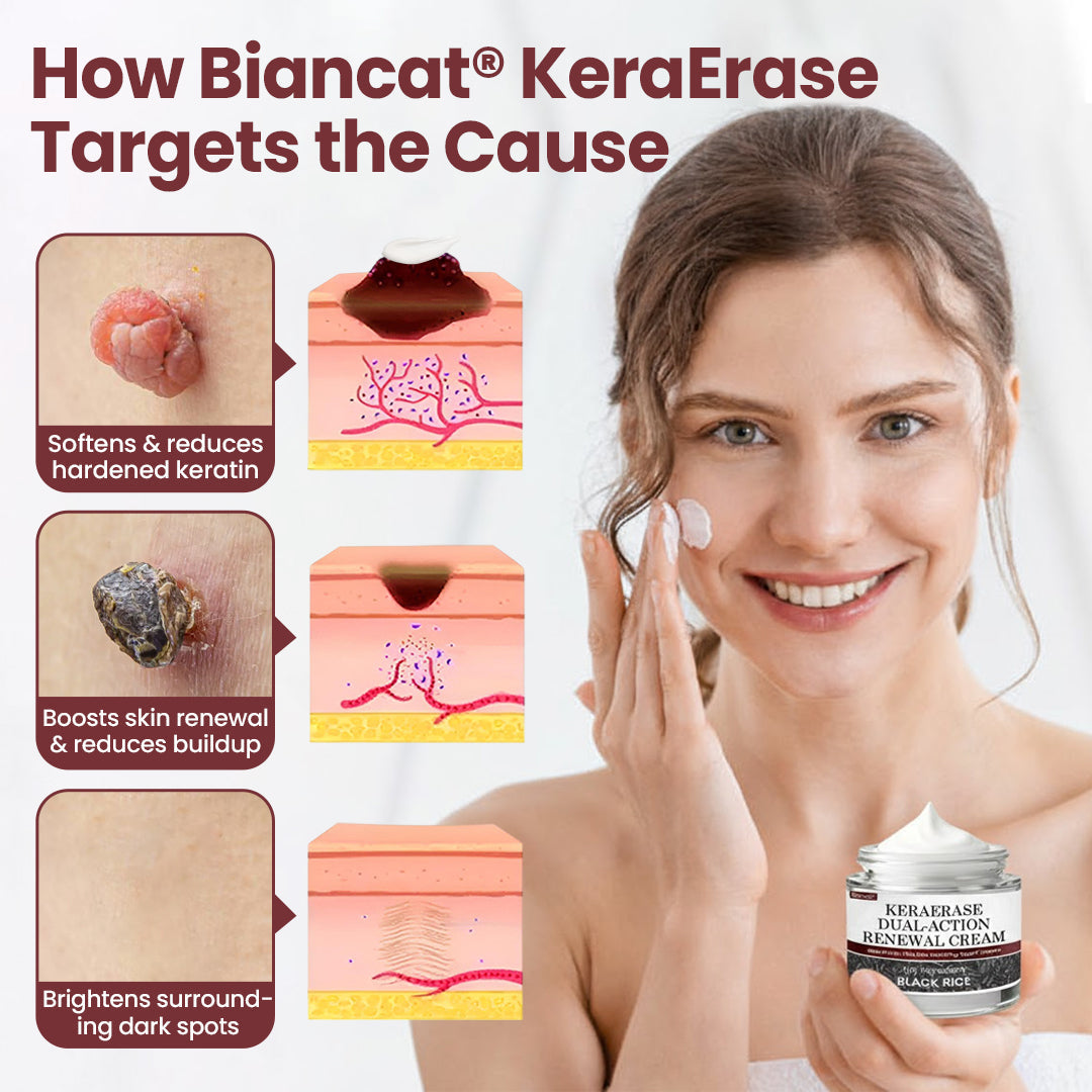 HZA® KeraErase Dual-Action Renewal Cream