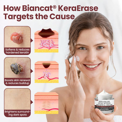 HZA® KeraErase Dual-Action Renewal Cream