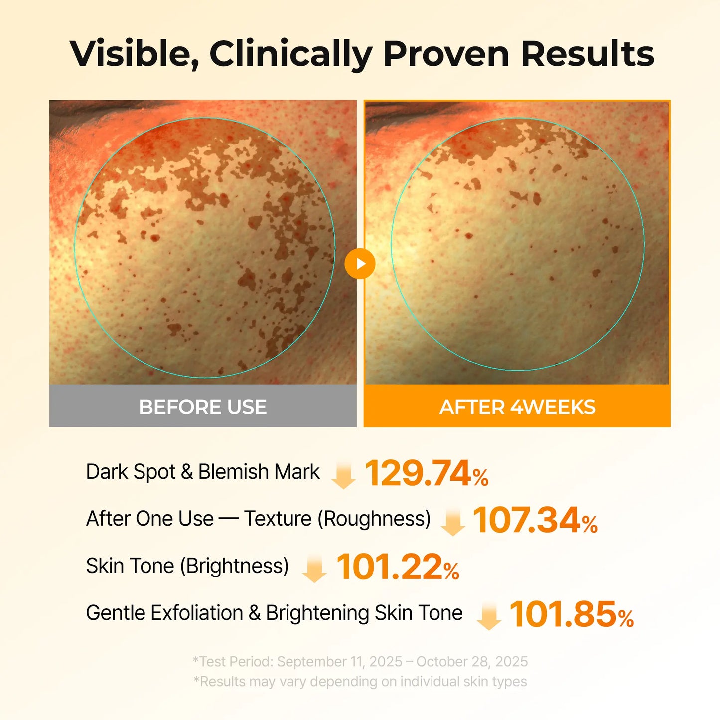 Cheemex® Kojic Acid Turmeric TX Toner Pad 70pads - Dark Spot & Pigmentation Care for Uneven Skin Tone