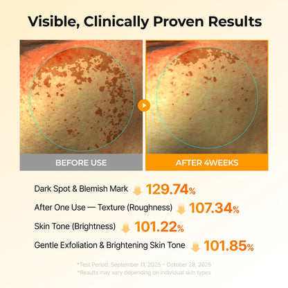 Cheemex® Kojic Acid Turmeric TX Toner Pad 70pads - Dark Spot & Pigmentation Care for Uneven Skin Tone