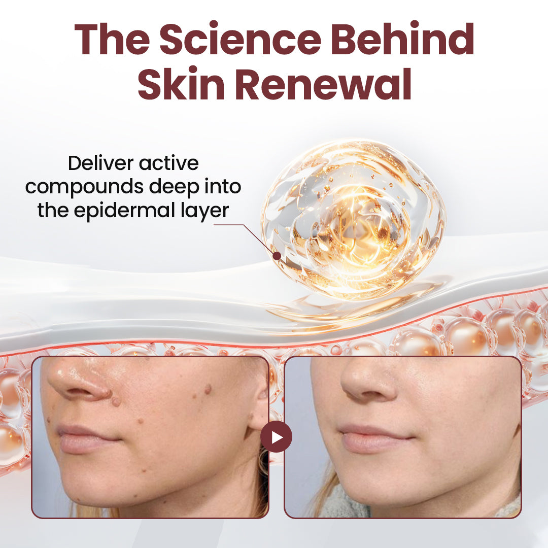 HZA® KeraErase Dual-Action Renewal Cream