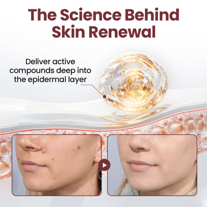 HZA® KeraErase Dual-Action Renewal Cream