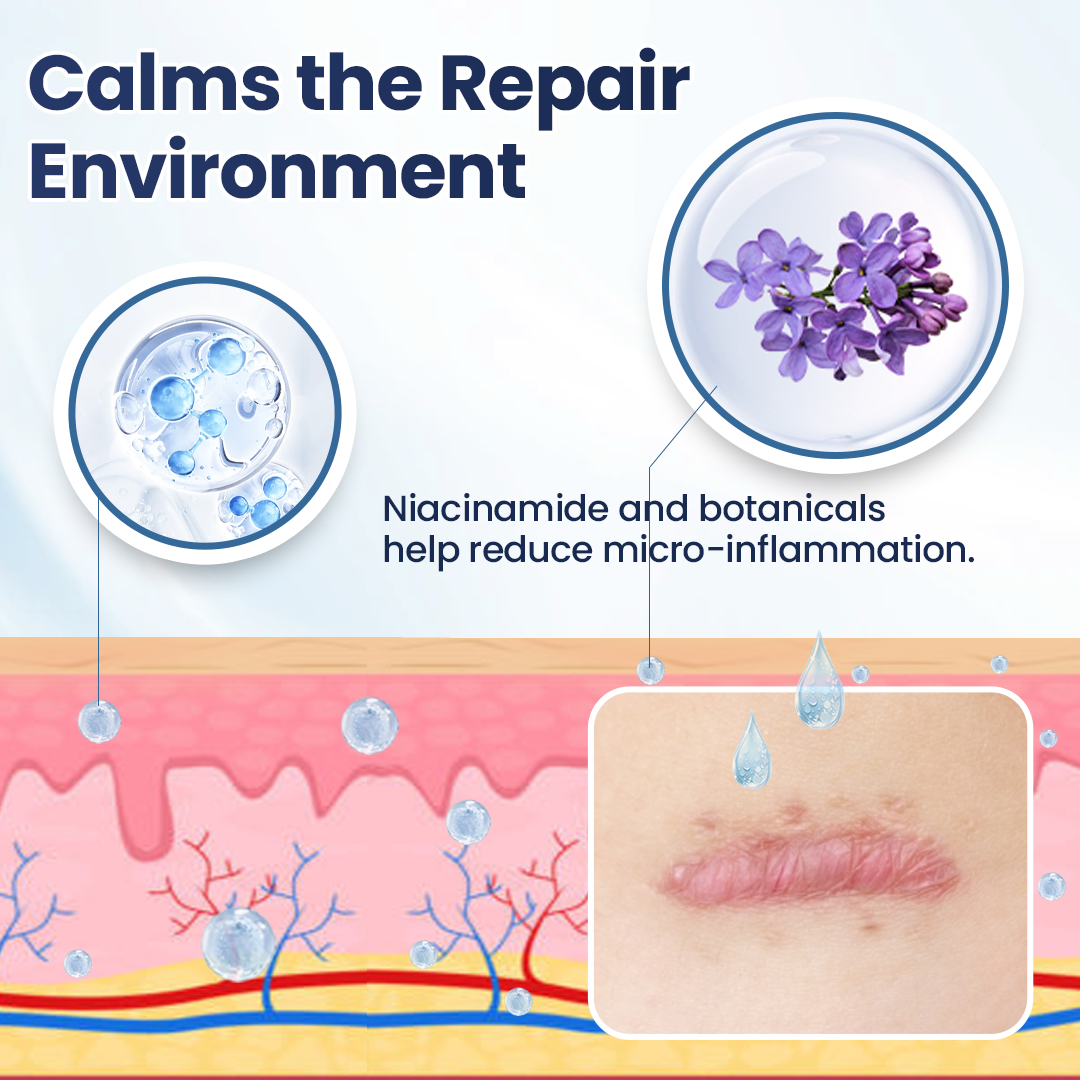🔥limited Time Discount🔥 Nexisify® DERMALUX Texture Repair Gel