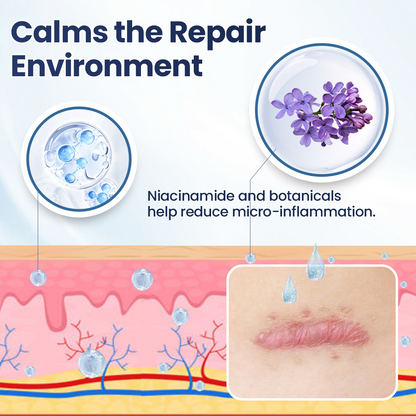 🔥limited Time Discount🔥 Nexisify® DERMALUX Texture Repair Gel