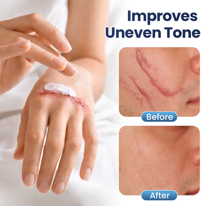 🔥limited Time Discount🔥 Nexisify® DERMALUX Texture Repair Gel