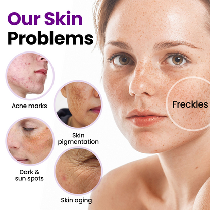 🔥Last day discount🔥Skavix® SpotRefiner Probiotic Shield Serum