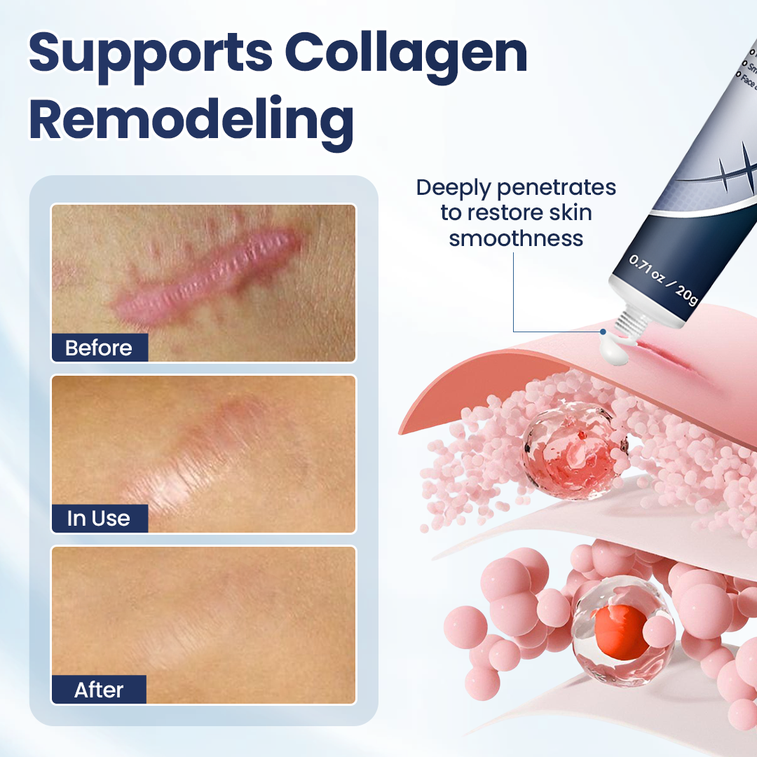 🔥limited Time Discount🔥 Nexisify® DERMALUX Texture Repair Gel