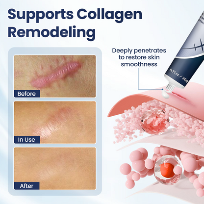 🔥limited Time Discount🔥 Nexisify® DERMALUX Texture Repair Gel