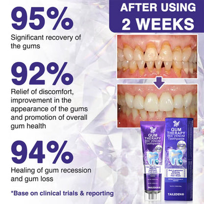 TAILEDEN®Bee Venom Dental Treatment Toothpaste-Comprehensive Oral Care Solutions