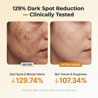 Cheemex® Kojic Acid Turmeric TX Toner Pad 70pads - Dark Spot & Pigmentation Care for Uneven Skin Tone