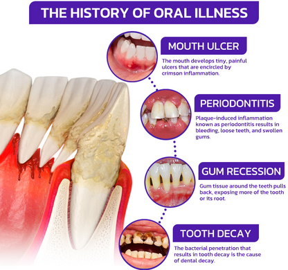 TAILEDEN®Bee Venom Dental Treatment Toothpaste-Comprehensive Oral Care Solutions